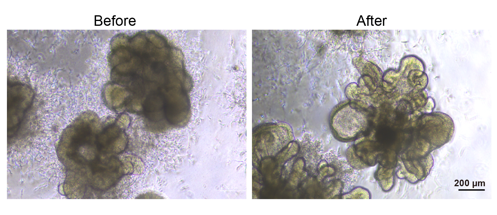 冻存型iPSC源小肠类器官，3d0230(图1)