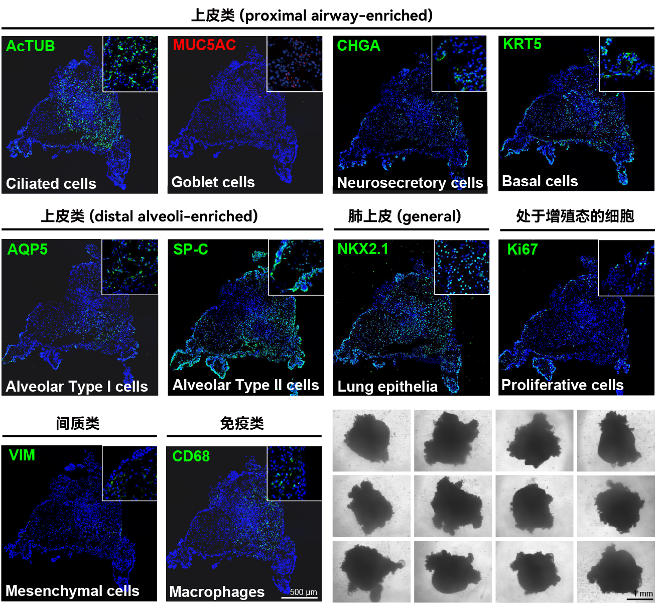 即用型iPSC源肺类器官 (d-model) ,3d0110.2(图1) 即用型iPSC源肺类器官 (d-model) ,3d0110.2(图1)
